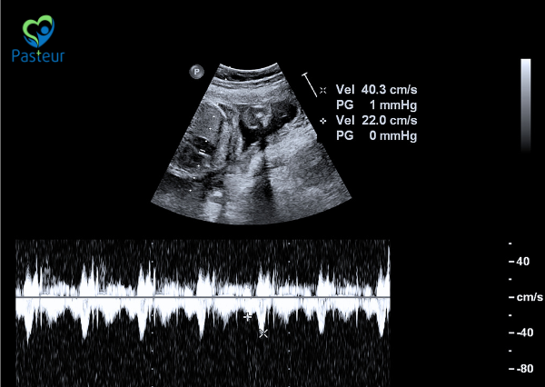 Siêu Âm Tim Thai: 4 Điều Mẹ Bầu Cần Biết Trong Thai Kỳ 1 siêu âm tim thai