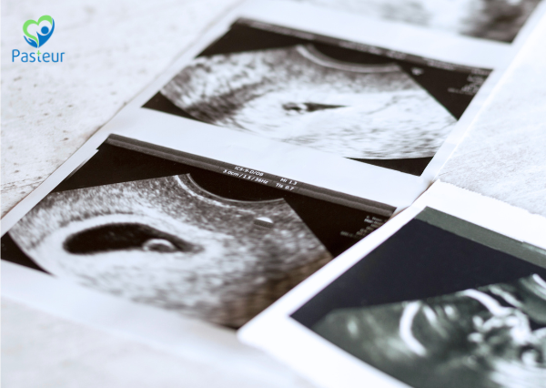 Siêu Âm Thai 4 Tuần Có Thấy Không 3 siêu âm thai 4 tuần có thấy không