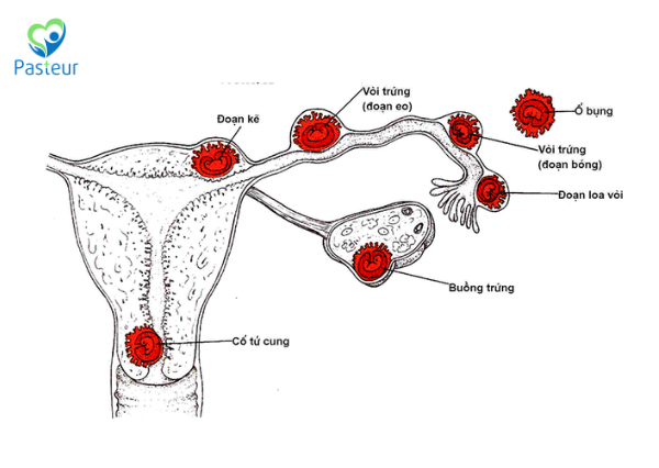 Mới Có Thai Có Nên Siêu Âm Đầu Dò Không? Ảnh minh họa