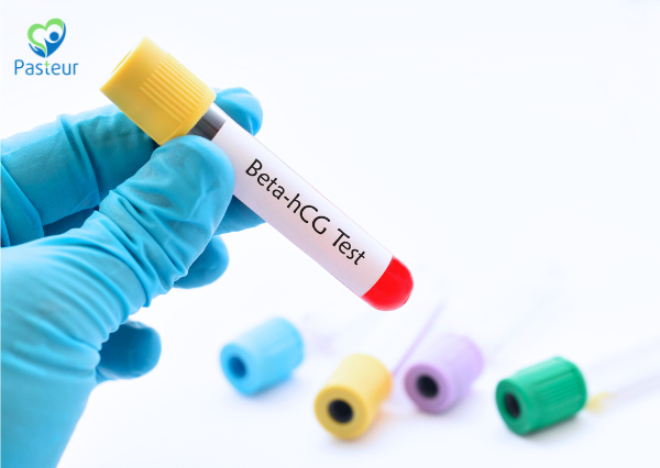 Siêu Âm Thai 4 Tuần Có Thấy Không 2 Siêu Âm Thai 4 Tuần Có Thấy Không Ảnh minh họa