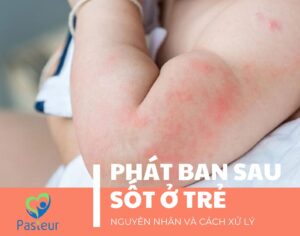 Phát Ban Sau Sốt: Nguyên Nhân Và Cách Xử Lý Ảnh minh họa