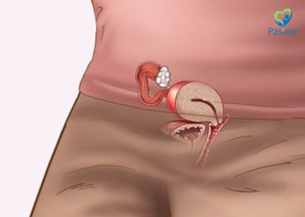 thai 3 tuần siêu âm có thấy không 