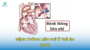 THÔNG LIÊN NHĨ Ở TRẺ EM (ASD)- BỆNH TIM BẨM SINH Ảnh minh họa