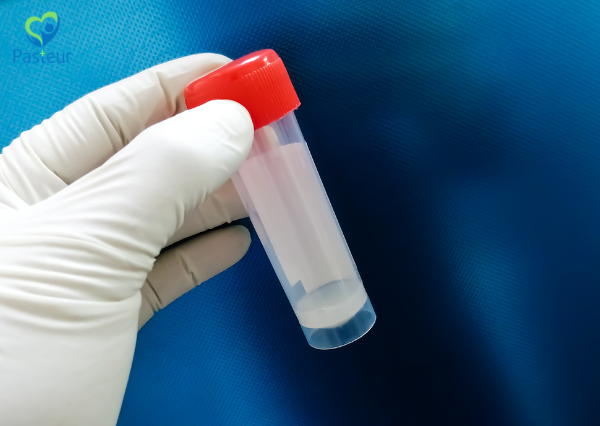 Cách lấy mẫu tinh dịch đồ chính xác và hiệu quả Ảnh minh họa