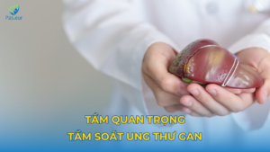 Tầm soát ung thư gan: Thông tin quan trọng cần biết Ảnh minh họa