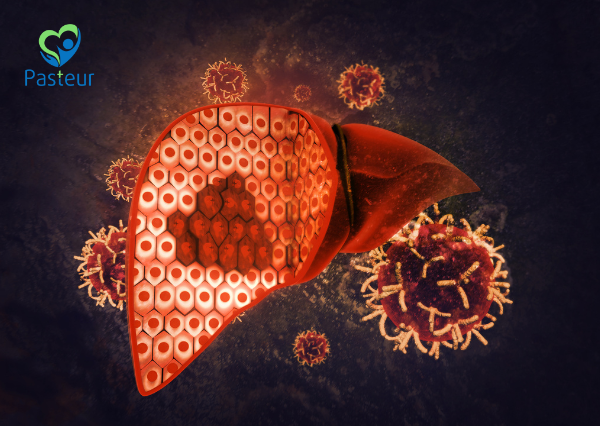 Tầm soát ung thư gan: Thông tin quan trọng cần biết 1 Tầm soát ung thư gan: Thông tin quan trọng cần biết Ảnh minh họa