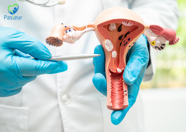 Viêm Phụ Khoa: Dấu Hiệu và Cách Phòng Ngừa Hiệu Quả Ảnh minh họa