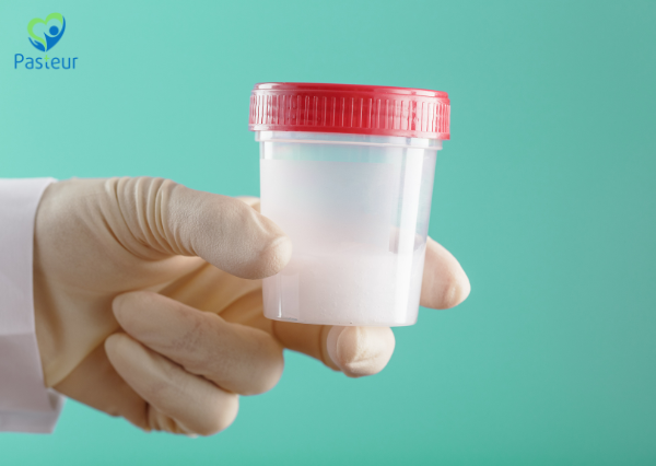 xét nghiệm tinh dịch đồ kiêng quan hệ bao lâu