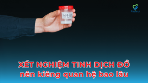 Xét nghiệm tinh dịch đồ cần kiêng quan hệ bao lâu? Ảnh minh họa
