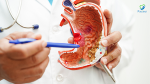 ĐAU DẠ DÀY NGUYÊN NHÂN TRIỆU CHỨNG VÀ CÁCH XỬ TRÍ Ảnh minh họa