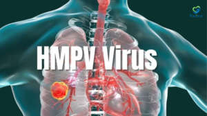 HMPV Triệu chứng chẩn đoán và phòng ngừa 13 HMPV Triệu chứng chẩn đoán và phòng ngừa Ảnh minh họa