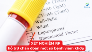 Xét Nghiệm RF: Hỗ Trợ Chẩn Đoán Viêm Khớp Dạng Thấp Ảnh minh họa
