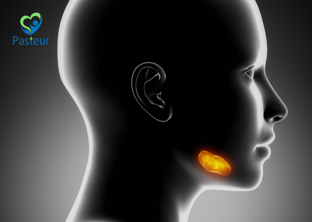 VIÊM TUYẾN NƯỚC BỌT Ảnh minh họa