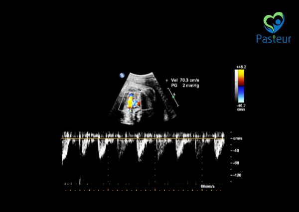 5 SỰ THẬT VỀ SIÊU ÂM TIM THAI Ảnh minh họa
