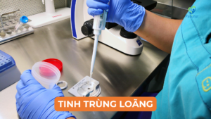 Tinh Trùng Loãng Là Gì? Nguyên Nhân, Dấu Hiệu Và Cách Cải Thiện 8 Tinh Trùng Loãng Là Gì? Nguyên Nhân, Dấu Hiệu Và Cách Cải Thiện Ảnh minh họa