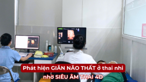 PHÁT HIỆN GIÃN NÃO THẤT Ở THAI NHI NHỜ SIÊU ÂM 4D Ảnh minh họa
