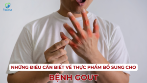 BỆNH GÚT BỔ SUNG NHỮNG THỰC PHẨM NÀO Ảnh minh họa