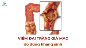 VIÊM ĐẠI TRÀNG GIẢ MẠC DO DÙNG KHÁNG SINH Ảnh minh họa