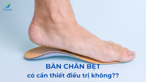 3 KIỂU BÀN CHÂN BẸT THƯỜNG GẶP Ảnh minh họa