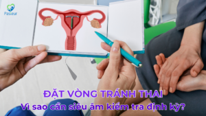 Đặt vòng tránh thai – Vì sao cần siêu âm định kỳ để kiểm tra? Ảnh minh họa