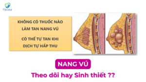 NANG VÚ: THEO DÕI HAY SINH THIẾT Ảnh minh họa
