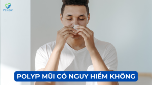 POLYP MŨI CÓ NGUY HIỂM KHÔNG? Ảnh minh họa