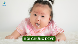 HỘI CHỨNG REYE LÀ GÌ? 12 HỘI CHỨNG REYE LÀ GÌ? Ảnh minh họa