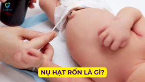 NỤ HẠT RỐN LÀ GÌ 11 NỤ HẠT RỐN LÀ GÌ Ảnh minh họa