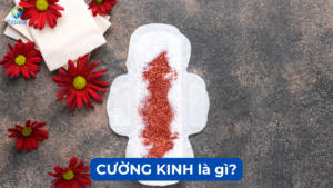 CƯỜNG KINH LÀ GÌ Ảnh minh họa
