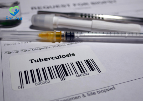 BỆNH LAO Ở TRẺ EM NHỮNG ĐIỀU BẠN CẦN BIẾT 2 BỆNH LAO Ở TRẺ EM NHỮNG ĐIỀU BẠN CẦN BIẾT Ảnh minh họa