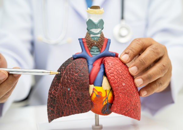 TÌM HIỂU KHÁI QUÁT VỀ ĐIỀU TRỊ TRÚNG ĐÍCH TRONG UNG THƯ PHỔI 1 tìm hiểu liệu pháp trúng đích trong ung thư phổi