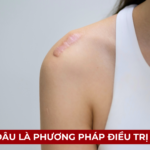 SẸO LỒI: ĐÂU LÀ PHƯƠNG PHÁP ĐIỀU TRỊ HIỆU QUẢ Ảnh minh họa