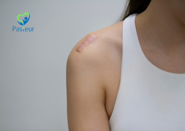 SẸO LỒI: ĐÂU LÀ PHƯƠNG PHÁP ĐIỀU TRỊ HIỆU QUẢ 2 phương pháp điều trị sẹo lồi