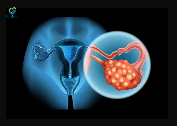 NANG Ở BUỒNG TRỨNG CÓ NGUY HIỂM KHÔNG 1 NANG Ở BUỒNG TRỨNG CÓ NGUY HIỂM KHÔNG Ảnh minh họa