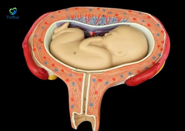 Thai ngôi ngang có nguy hiểm không? Dấu hiệu nhận biết và cách xử trí Ảnh minh họa