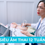 SIÊU ÂM 12 TUẦN CẦN KIỂM TRA GÌ? Ảnh minh họa