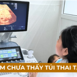 SIÊU ÂM KHÔNG THẤY TÚI THAI 04 NGUYÊN NHÂN Ảnh minh họa