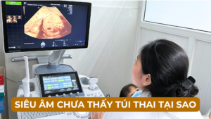 SIÊU ÂM KHÔNG THẤY TÚI THAI 04 NGUYÊN NHÂN Ảnh minh họa
