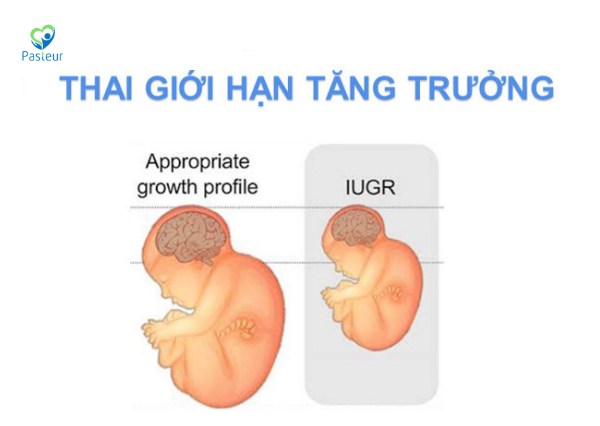 THAI GIỚI HẠN TĂNG TRƯỞNG DO ĐÂU? Ảnh minh họa