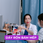 DÂY RỐN BÁM MÉP LÀ GÌ Ảnh minh họa
