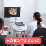 HỞ EO TỬ CUNG ĐIỀU TRỊ NHƯ THẾ NÀO Ảnh minh họa