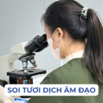 SOI TƯƠI DỊCH ÂM ĐẠO KHI NÀO NÊN THỰC HIỆN Ảnh minh họa