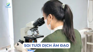 SOI TƯƠI DỊCH ÂM ĐẠO KHI NÀO NÊN THỰC HIỆN Ảnh minh họa