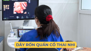 DÂY RỐN QUẤN CỔ CÓ NGUY HIỂM KHÔNG ? Ảnh minh họa