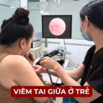 VIÊM TAI GIỮA Ở TRẺ EM Ảnh minh họa