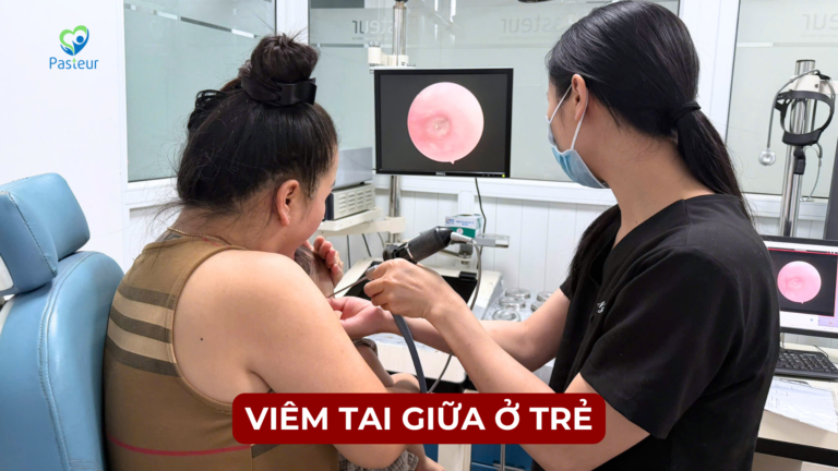 VIÊM TAI GIỮA Ở TRẺ EM Ảnh minh họa