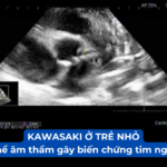 KAWASAKI Ở TRẺ NHỎ: VÌ SAO CÓ THỂ ÂM THẦM GÂY BIẾN CHỨNG TIM NGHIÊM TRỌNG Ảnh minh họa