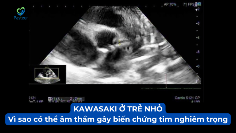 KAWASAKI Ở TRẺ NHỎ: VÌ SAO CÓ THỂ ÂM THẦM GÂY BIẾN CHỨNG TIM NGHIÊM TRỌNG Ảnh minh họa